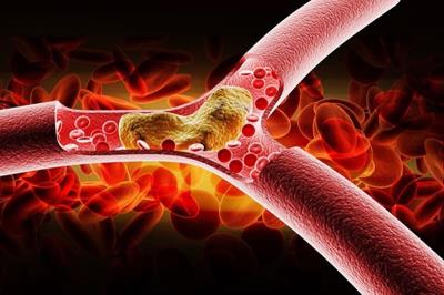CÁC BÀI THUỐC ĐÔNG Y GIẢM MỠ MÁU
